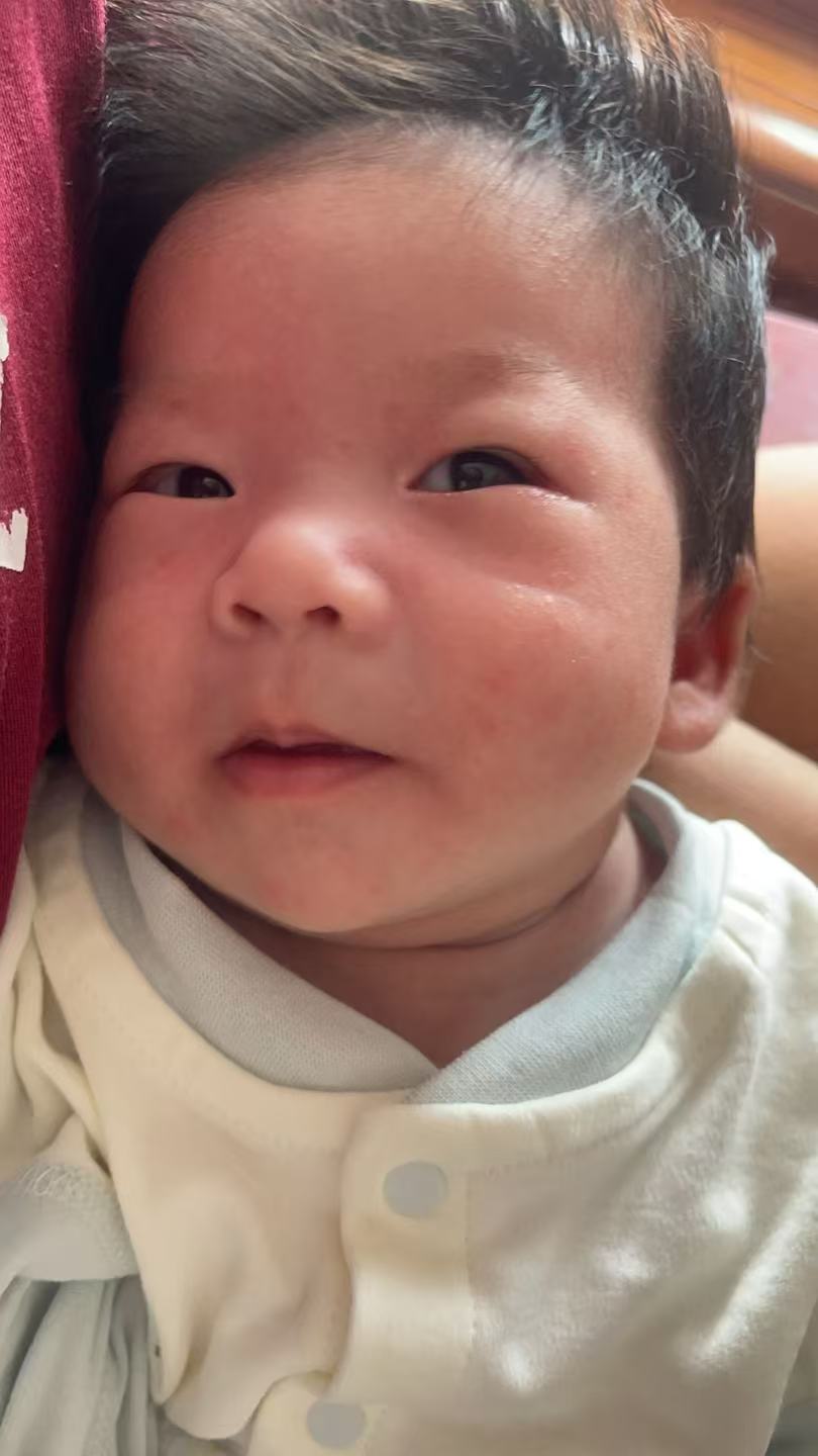 产后湿疹困扰:宝宝满脸红疹怎么办?