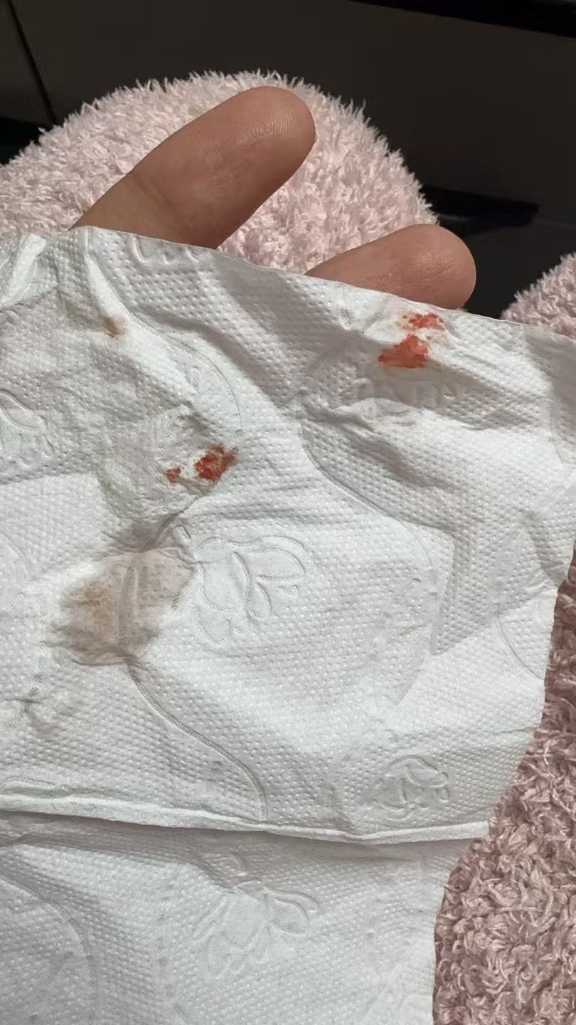 孕期突发见红，紧急就医经历