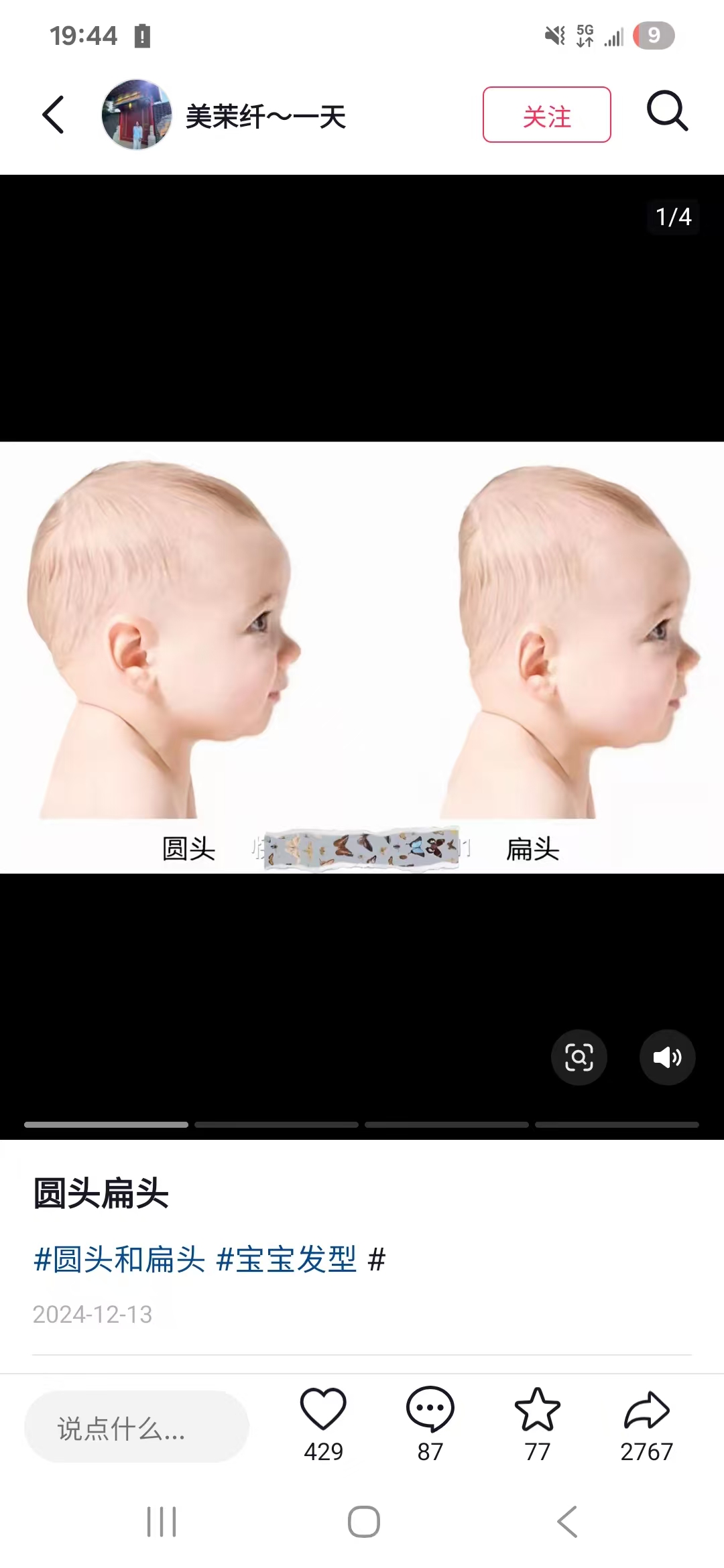 新生儿喂养经验分享