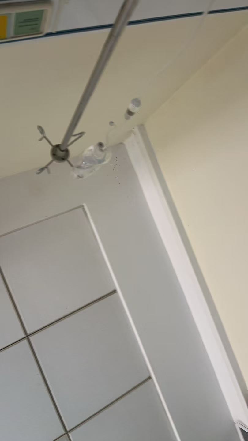 剖腹产后的恢复经历