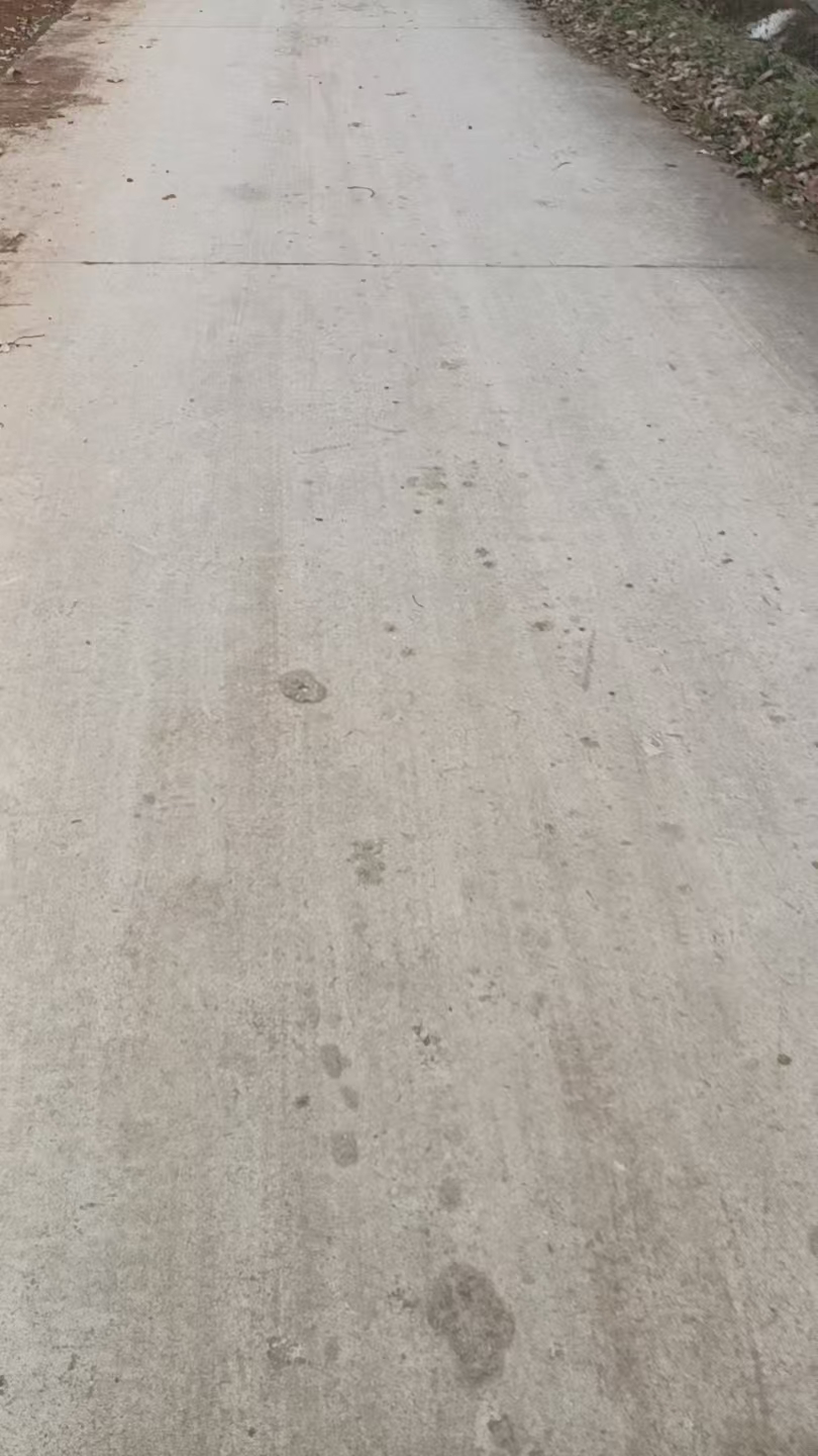 产后恢复与宫缩疼痛的亲身经历