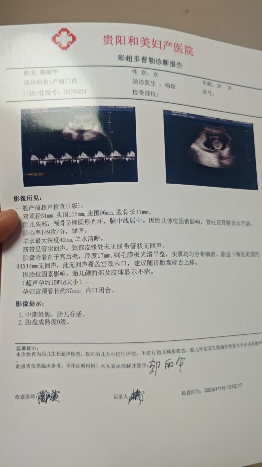 孕期胎盘低置的困扰与应对