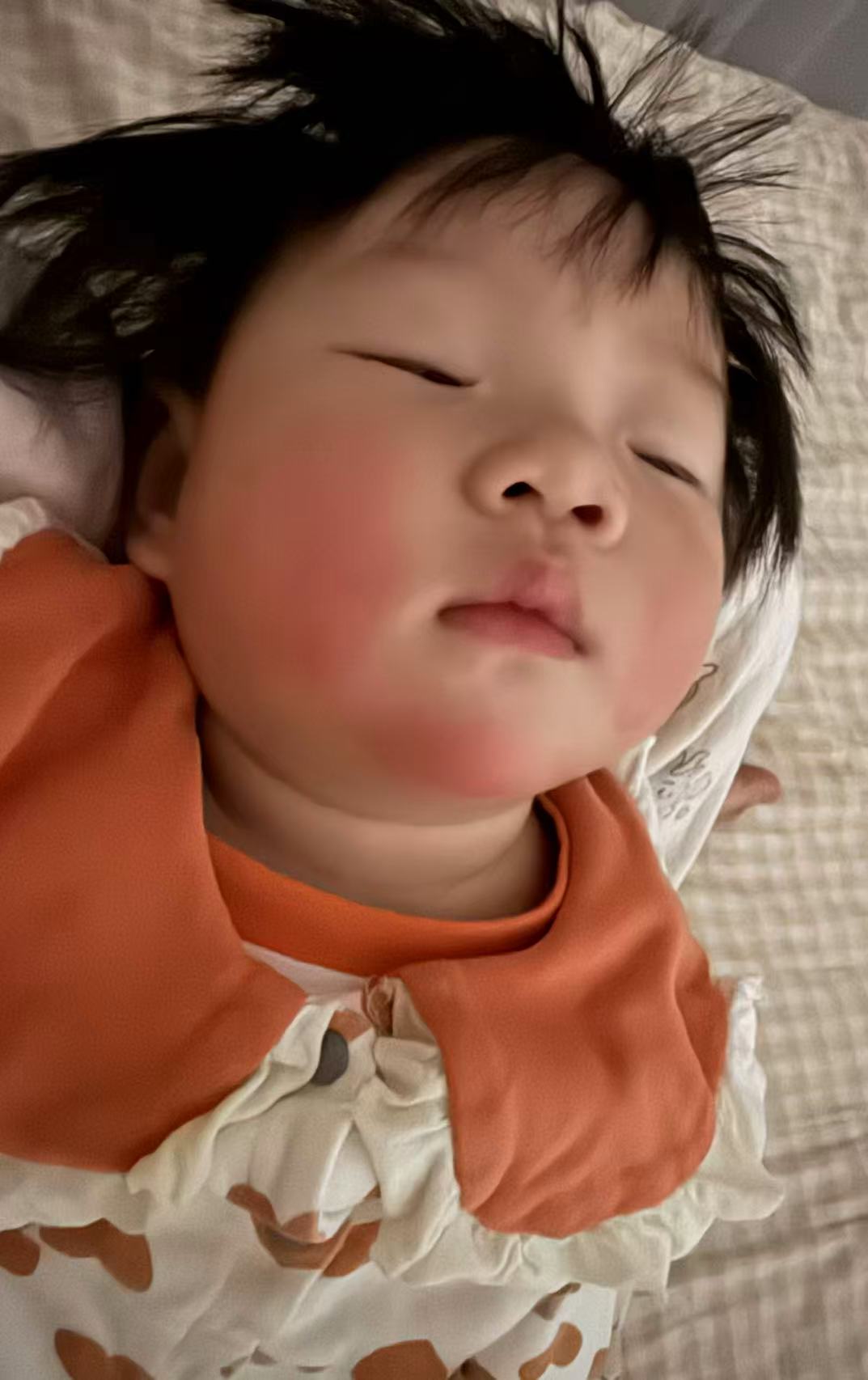 宝宝口水疹护理心得