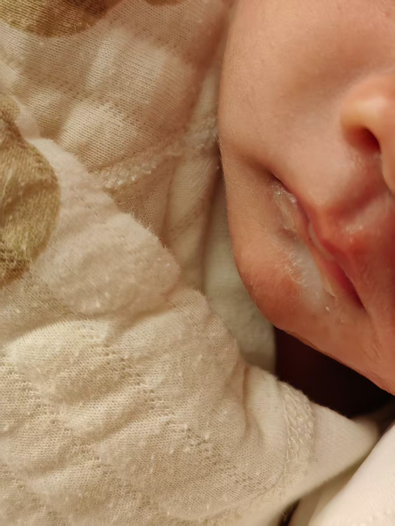 剖腹产后的恢复与母乳喂养