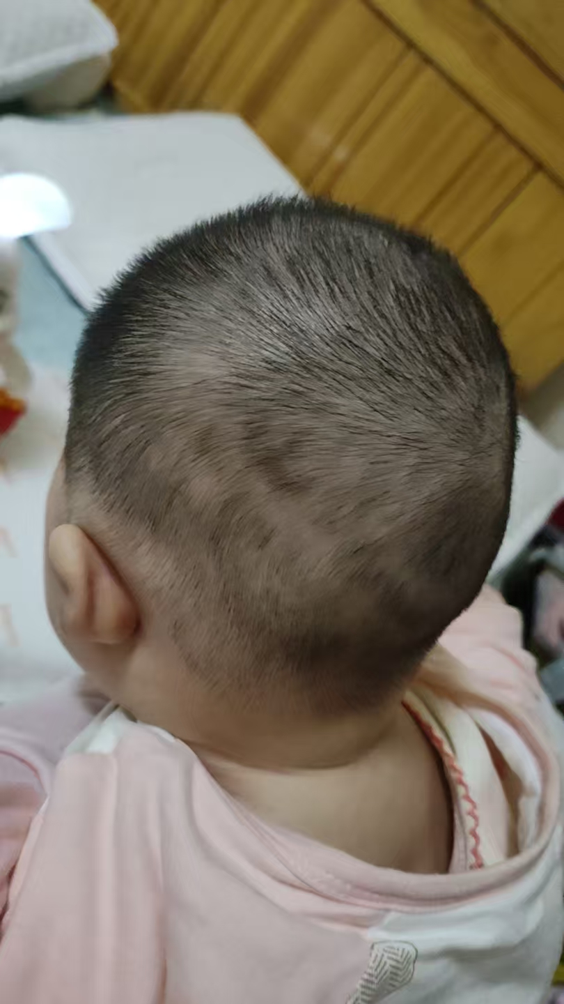 宝宝头型调整小技巧