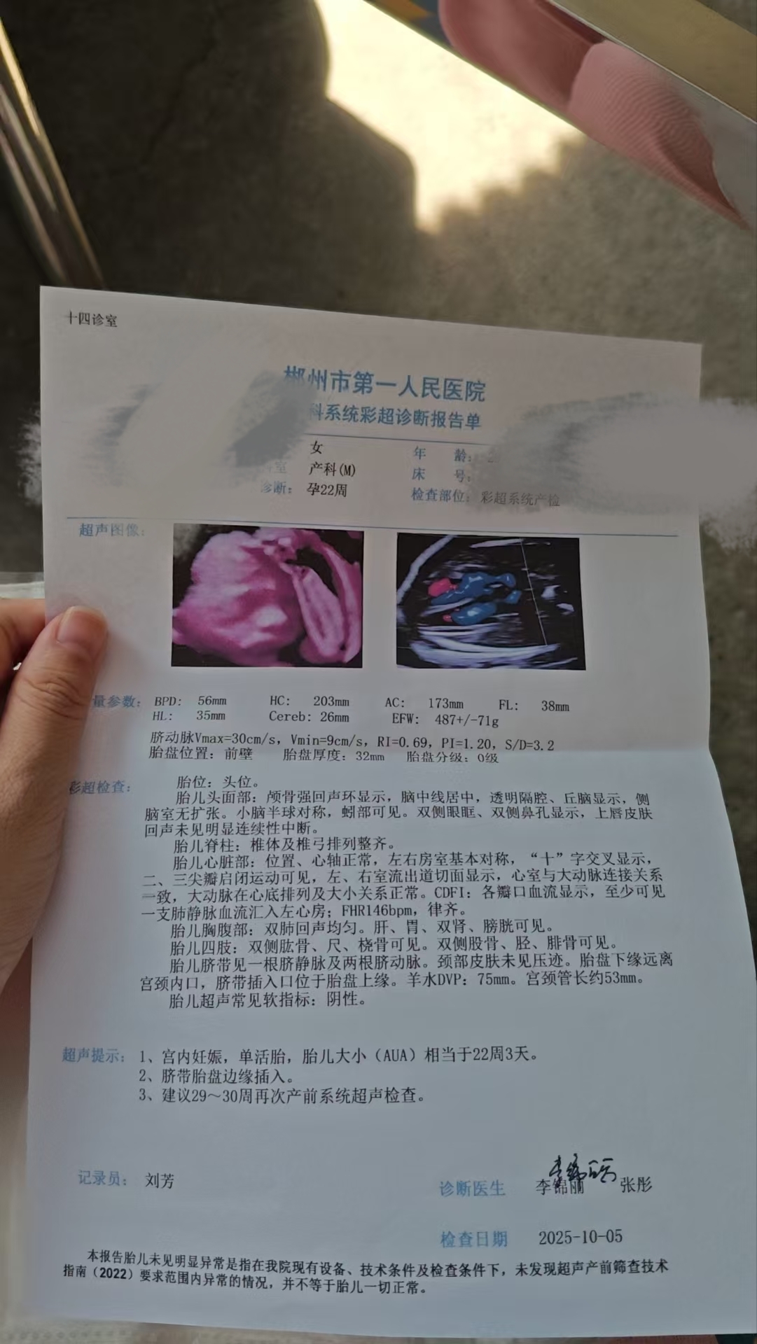 孕期胎动的小烦恼