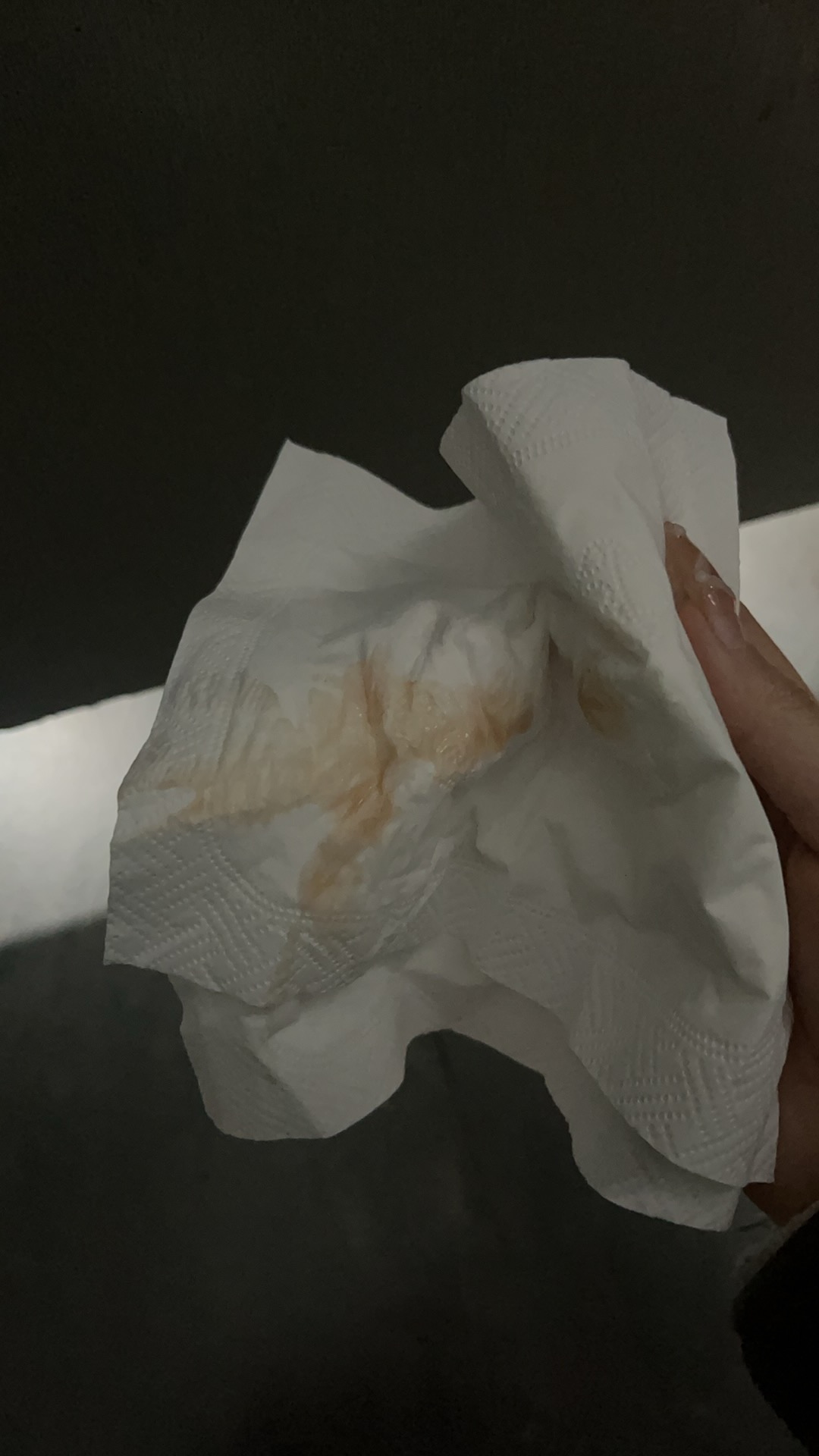 孕期褐色分泌物别慌张，我的保胎经历分享