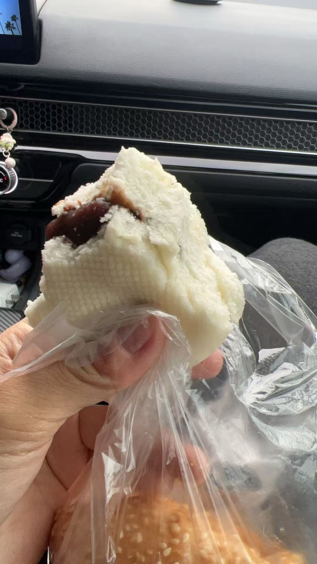 四维检查的波折经历