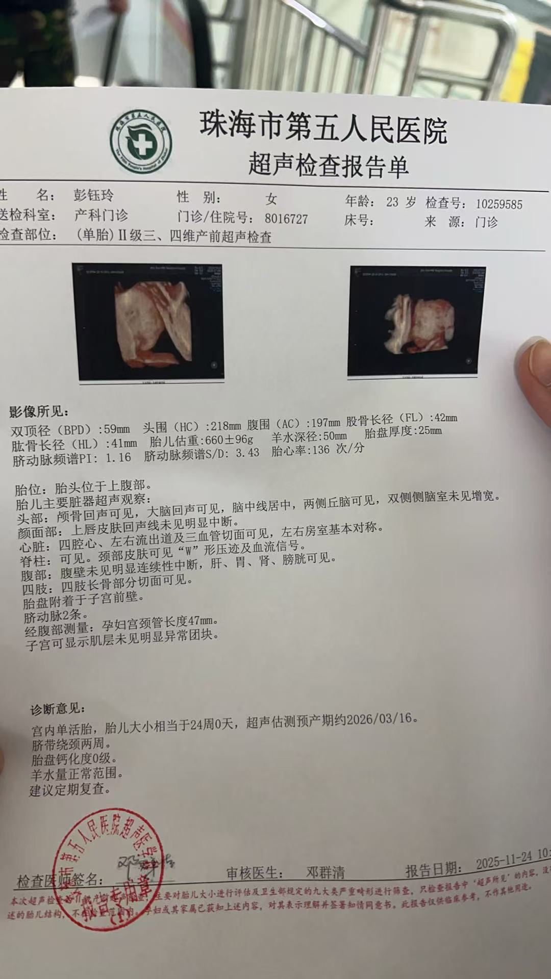 四维检查的波折经历