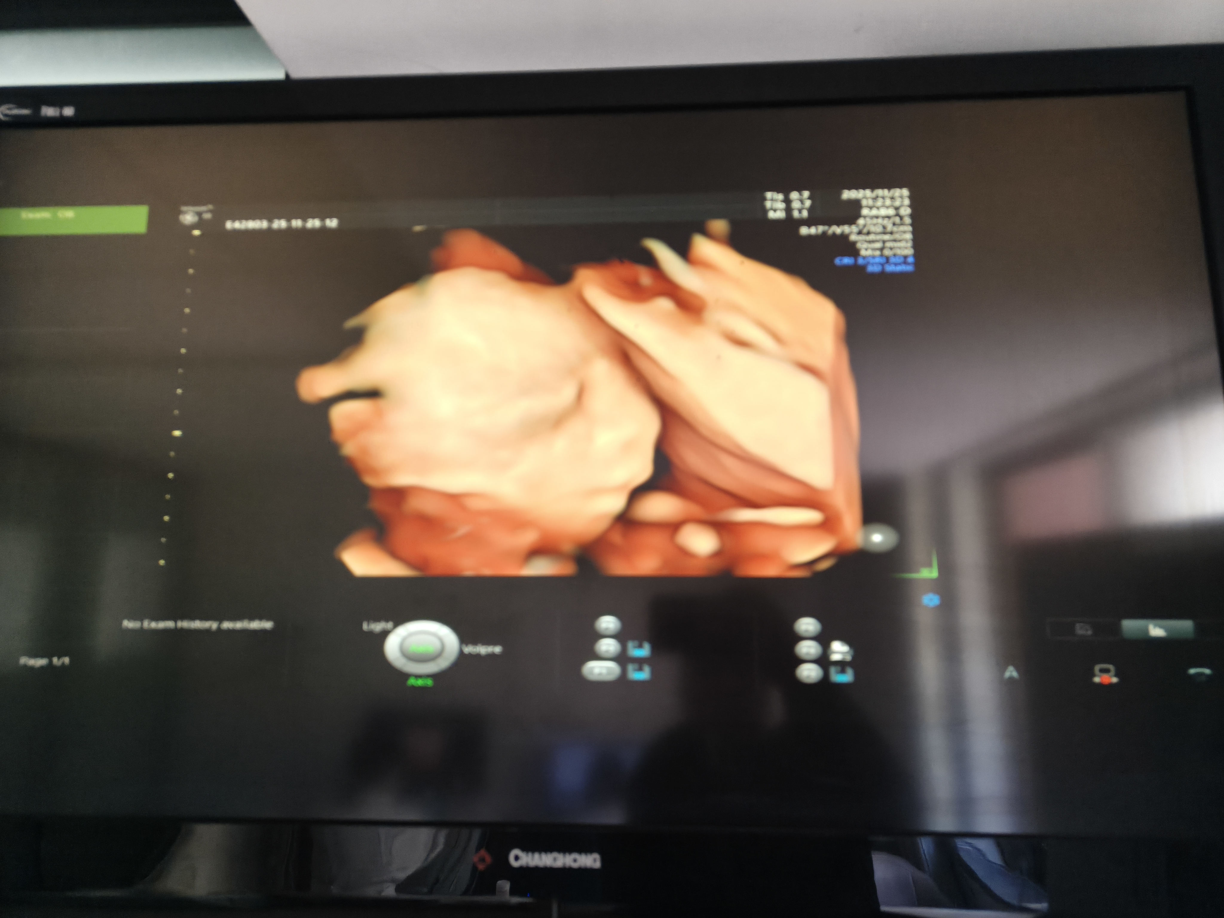 四维彩超的趣事：宝宝就是不配合