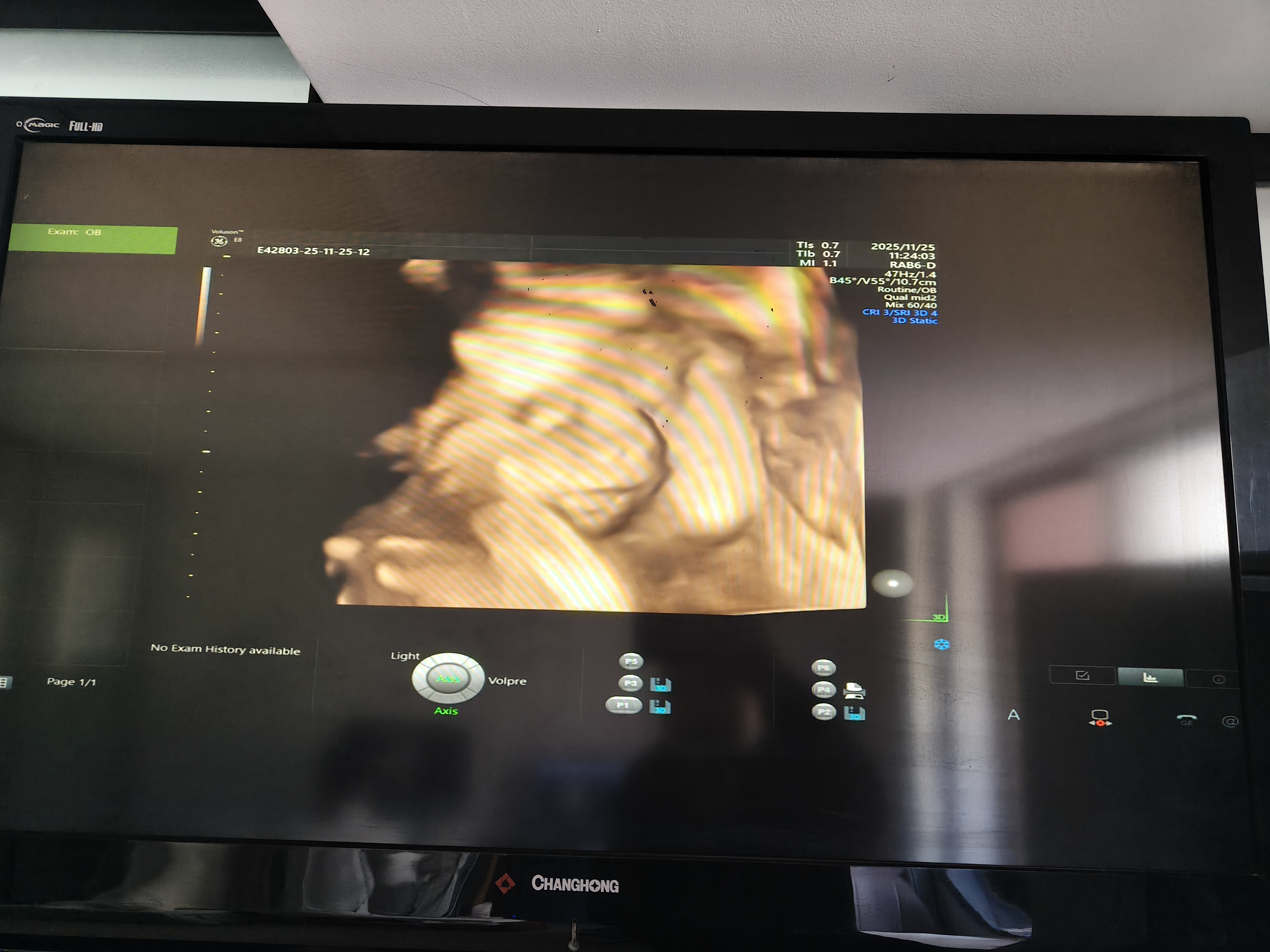 四维彩超的趣事：宝宝就是不配合