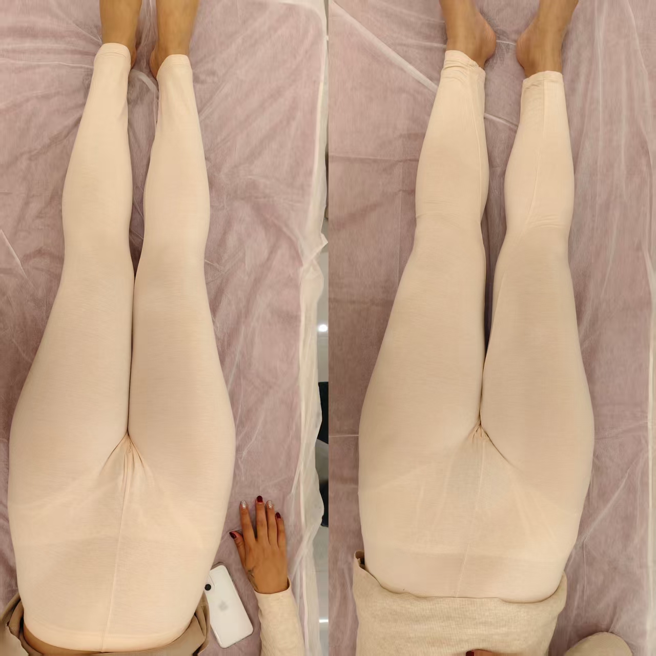 产后修复的纠结与选择