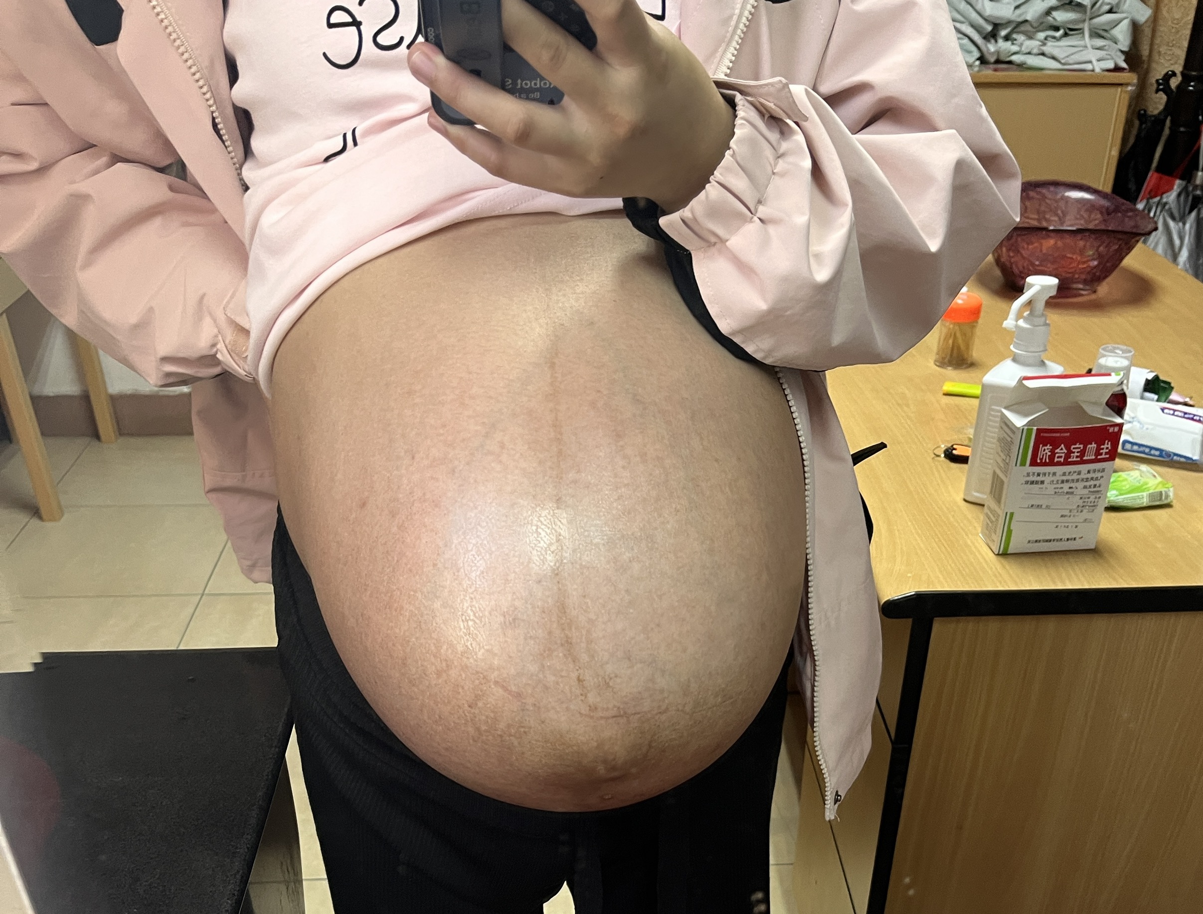 悬垂腹孕妈的烦恼