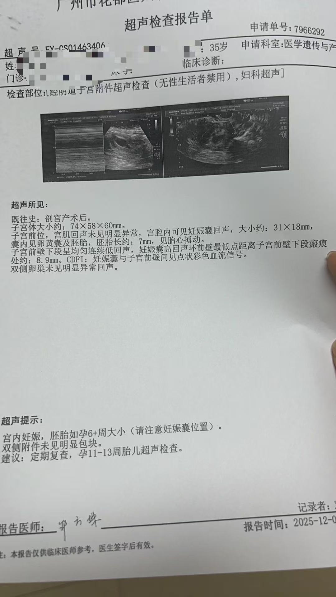 高龄孕妇的产检焦虑