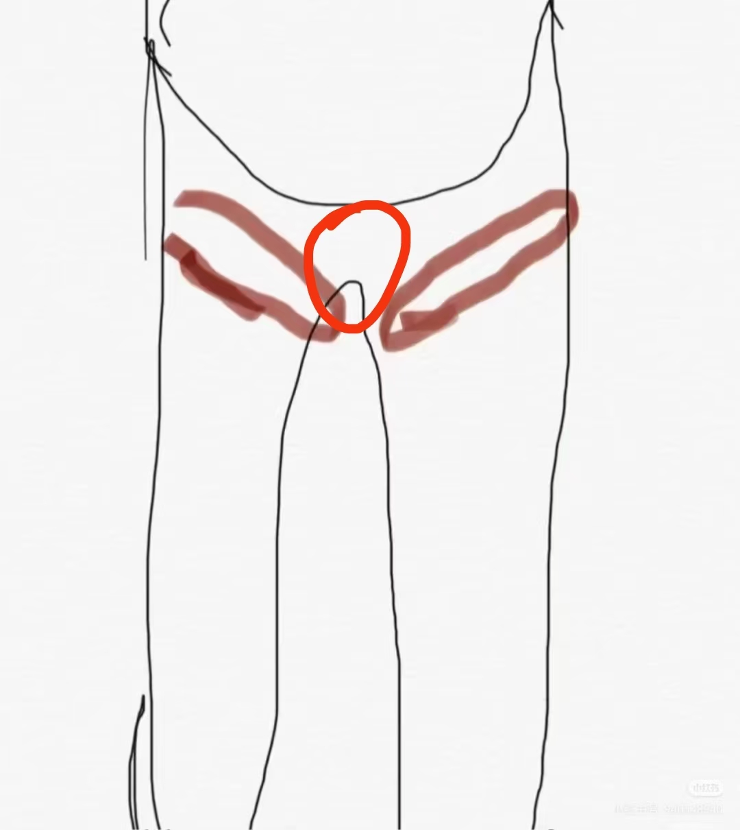 孕晚期耻骨痛的困扰
