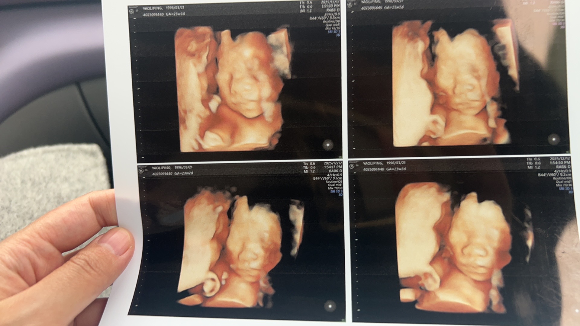 四维检查一次过的小技巧分享