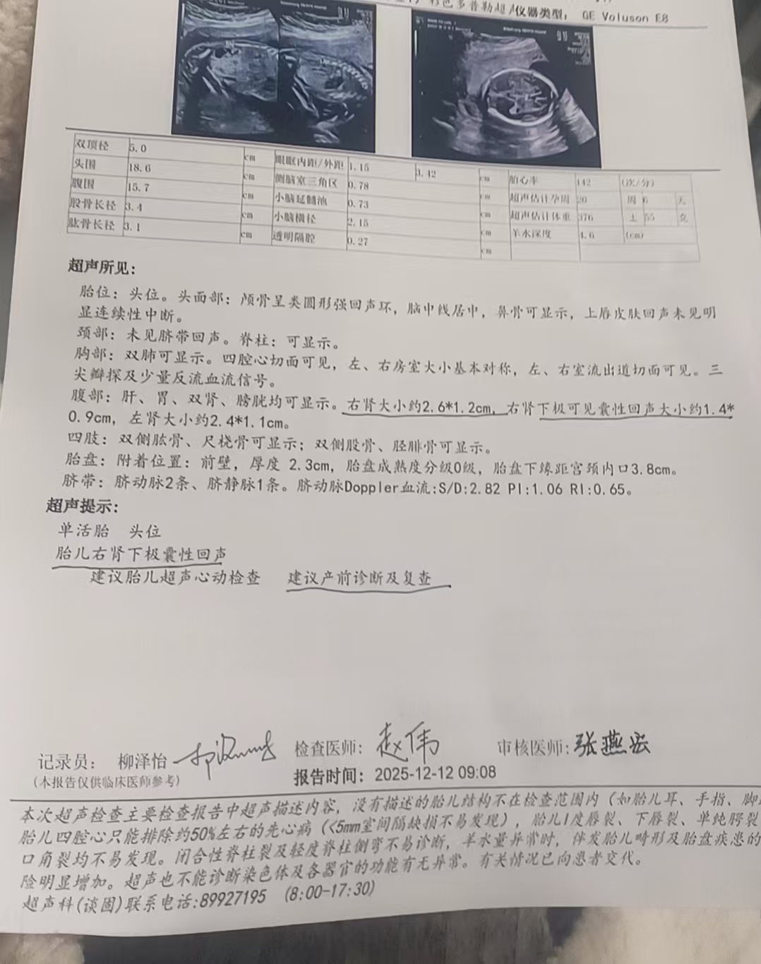 孕期产检的那些事儿