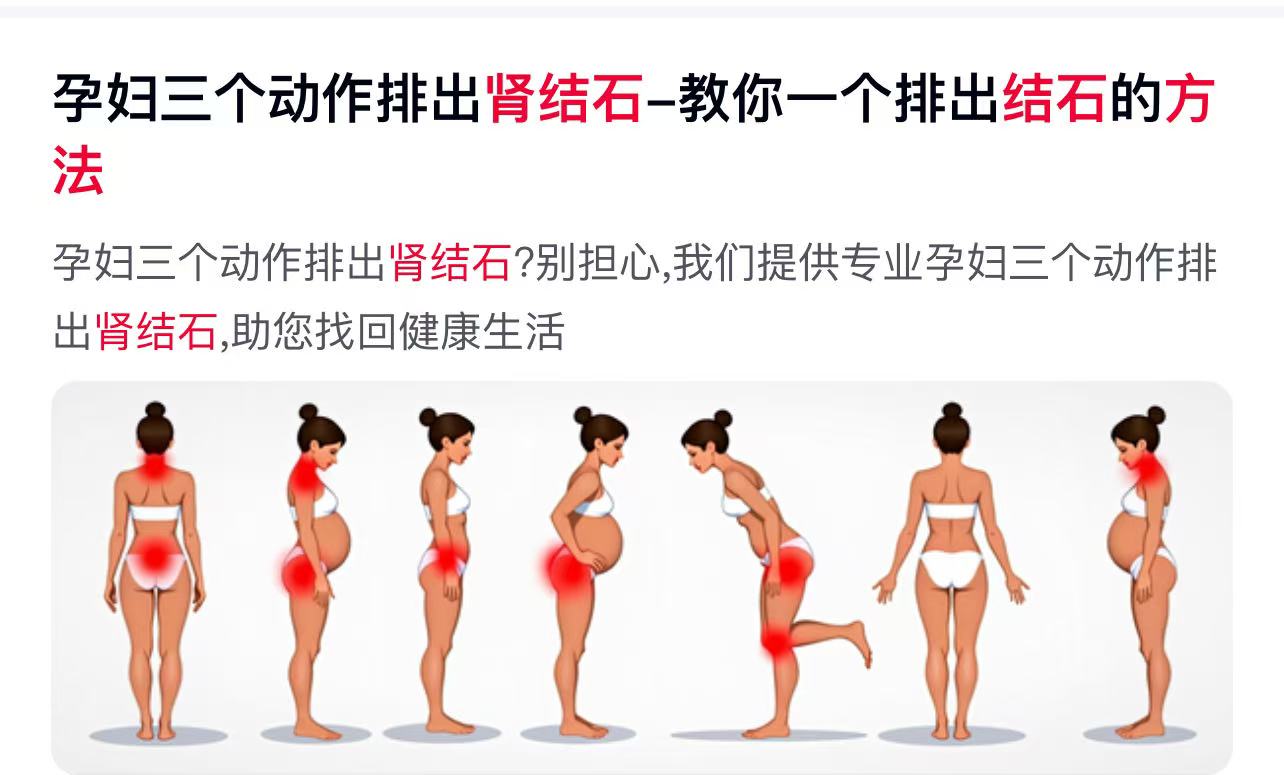 孕期肾结石的痛,谁懂啊!