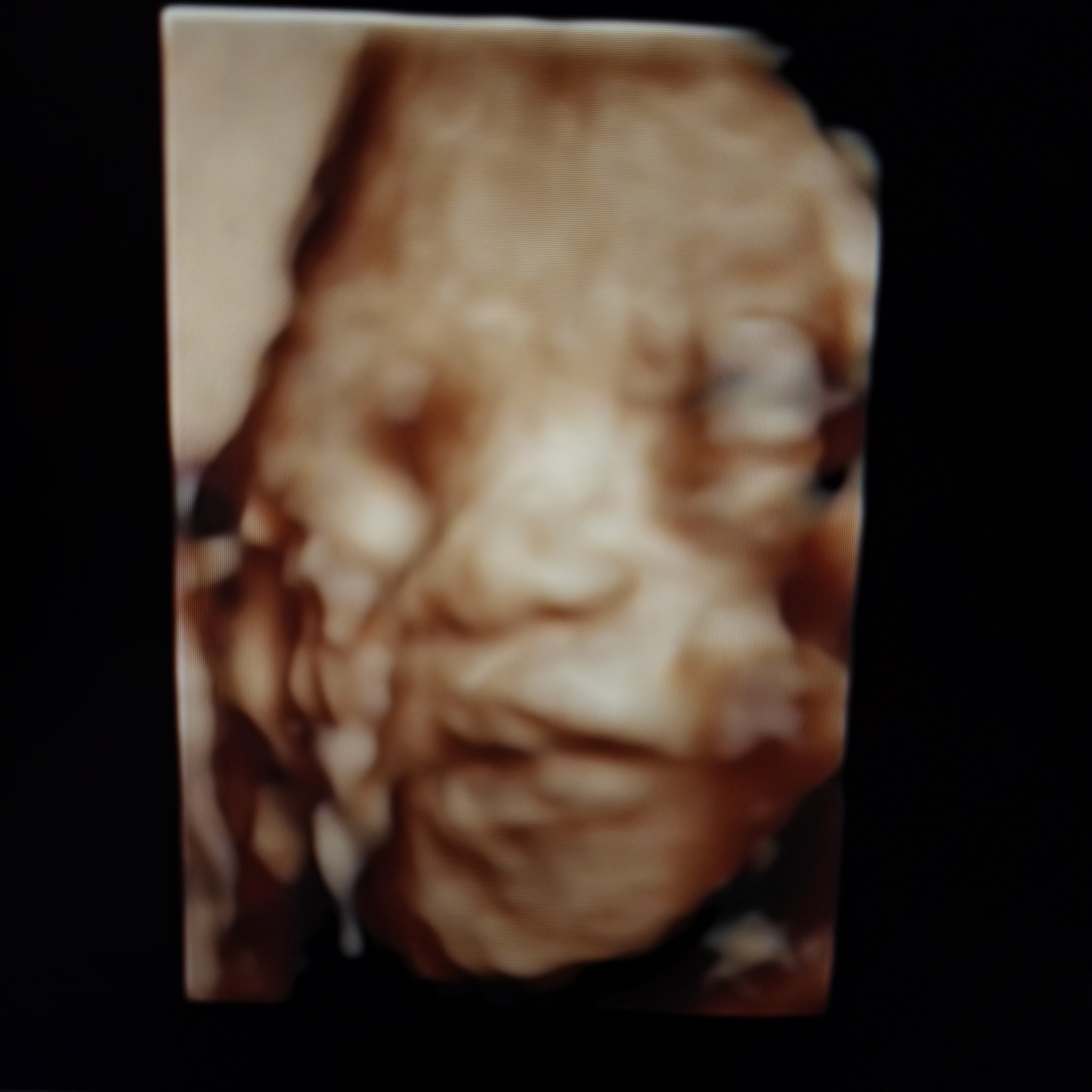 四维检查一次过攻略