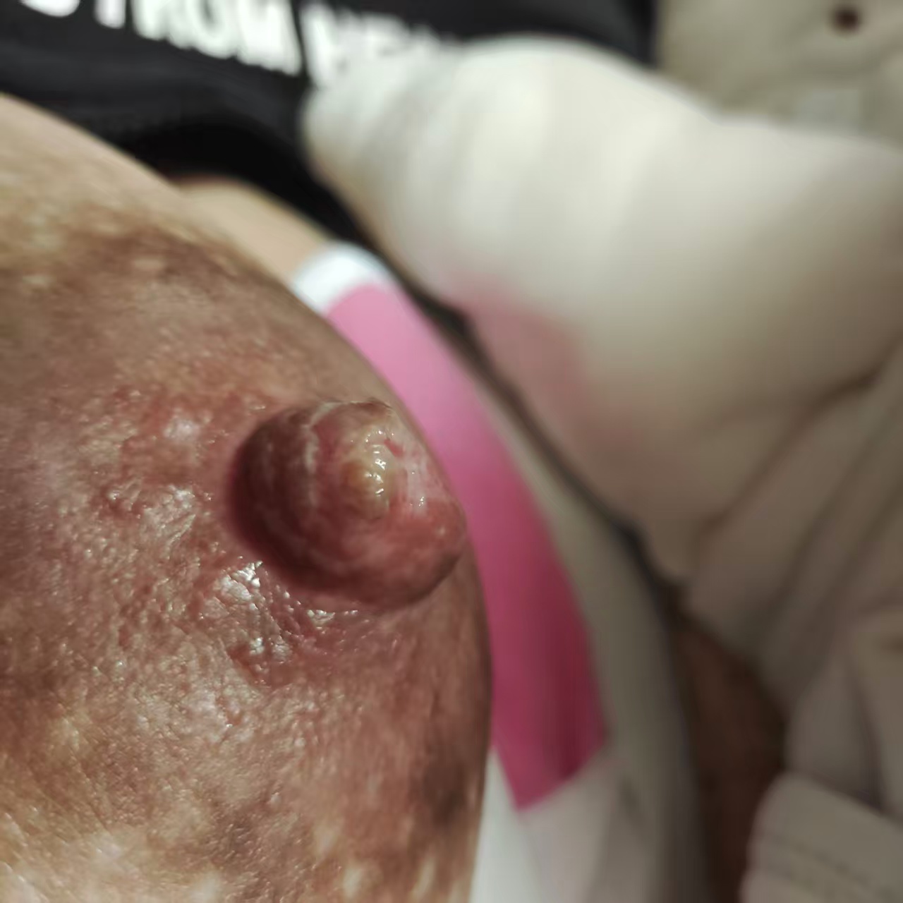 月子里的那些事儿