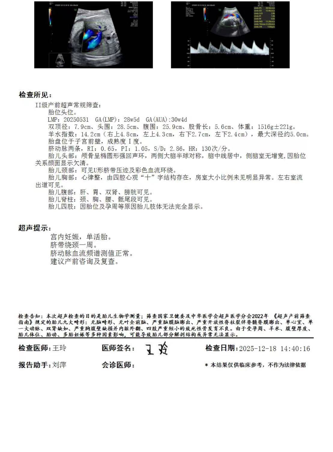 孕期穿搭分享：一条实用又显瘦的孕妇裤