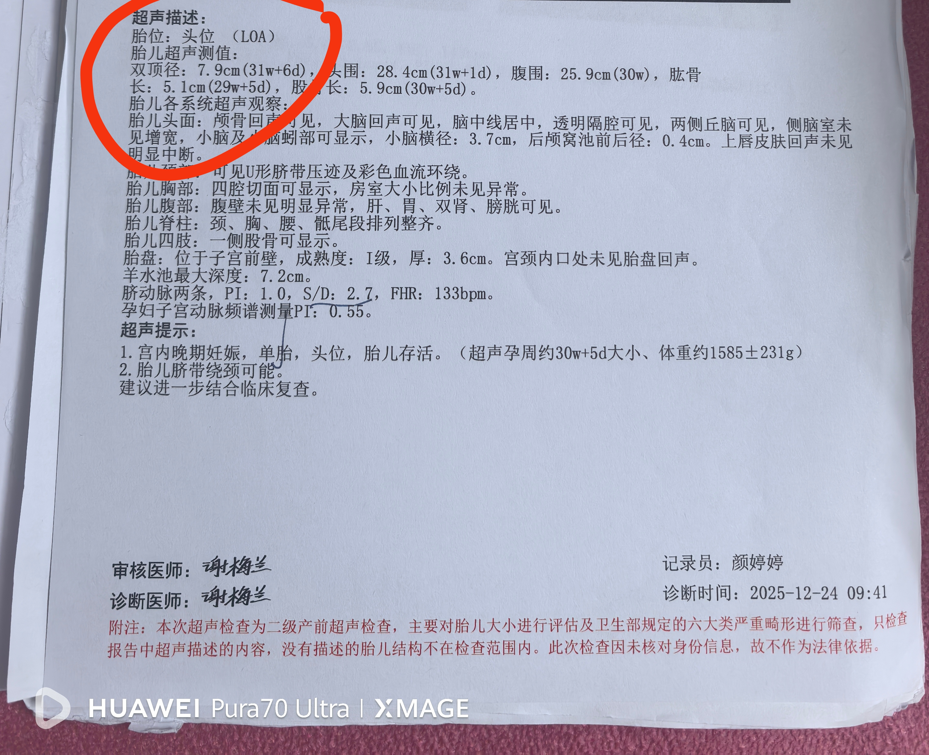 孕期胎位那些事儿